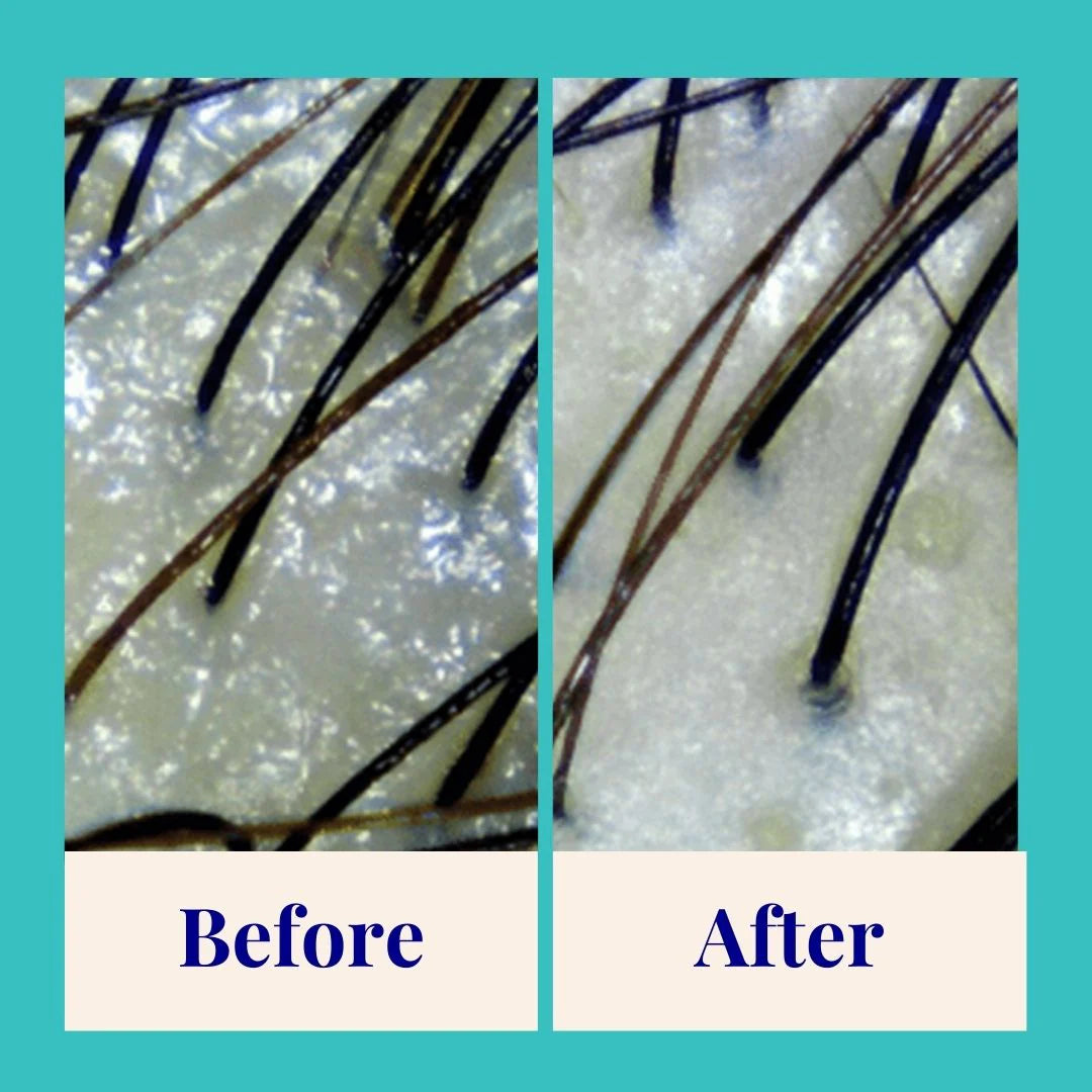 Purifying Shampoo For Oily Scalp & Limp Hair Peppermint & Papaya Enzyme
