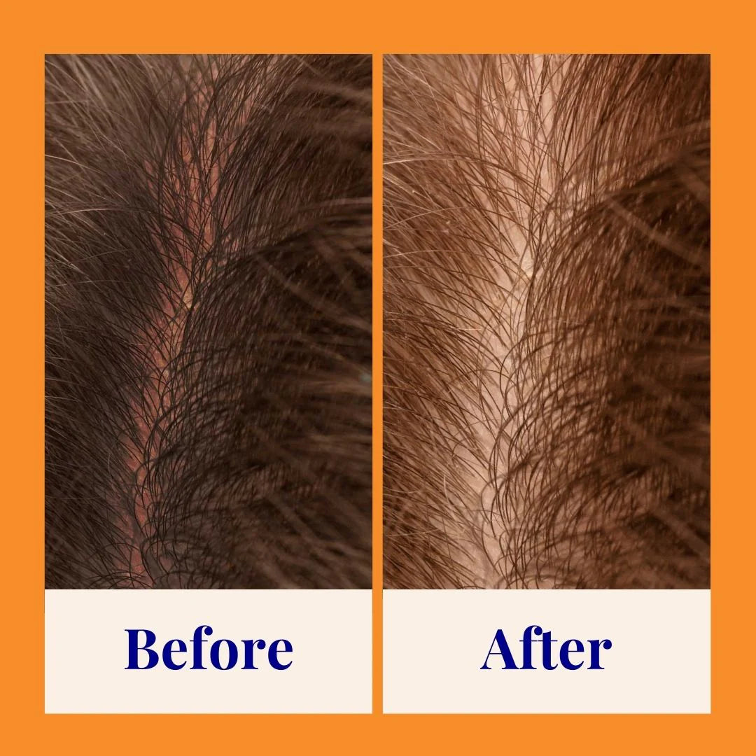 Strengthening Shampoo For Normal & Sensitive Scalps Grapefruit & Probiotics